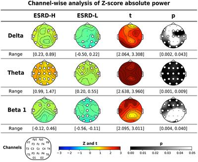 QEEG characteristics associated with malnutrition-inflammation complex syndrome
